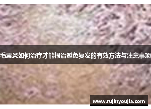 毛囊炎如何治疗才能根治避免复发的有效方法与注意事项 毛囊炎如何治疗才能根治避免复发的有效方法与注意事项